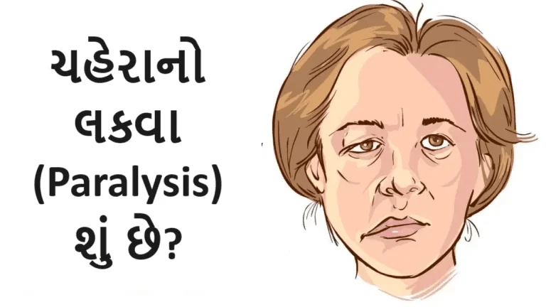 ચહેરાનો લકવા (Paralysis)