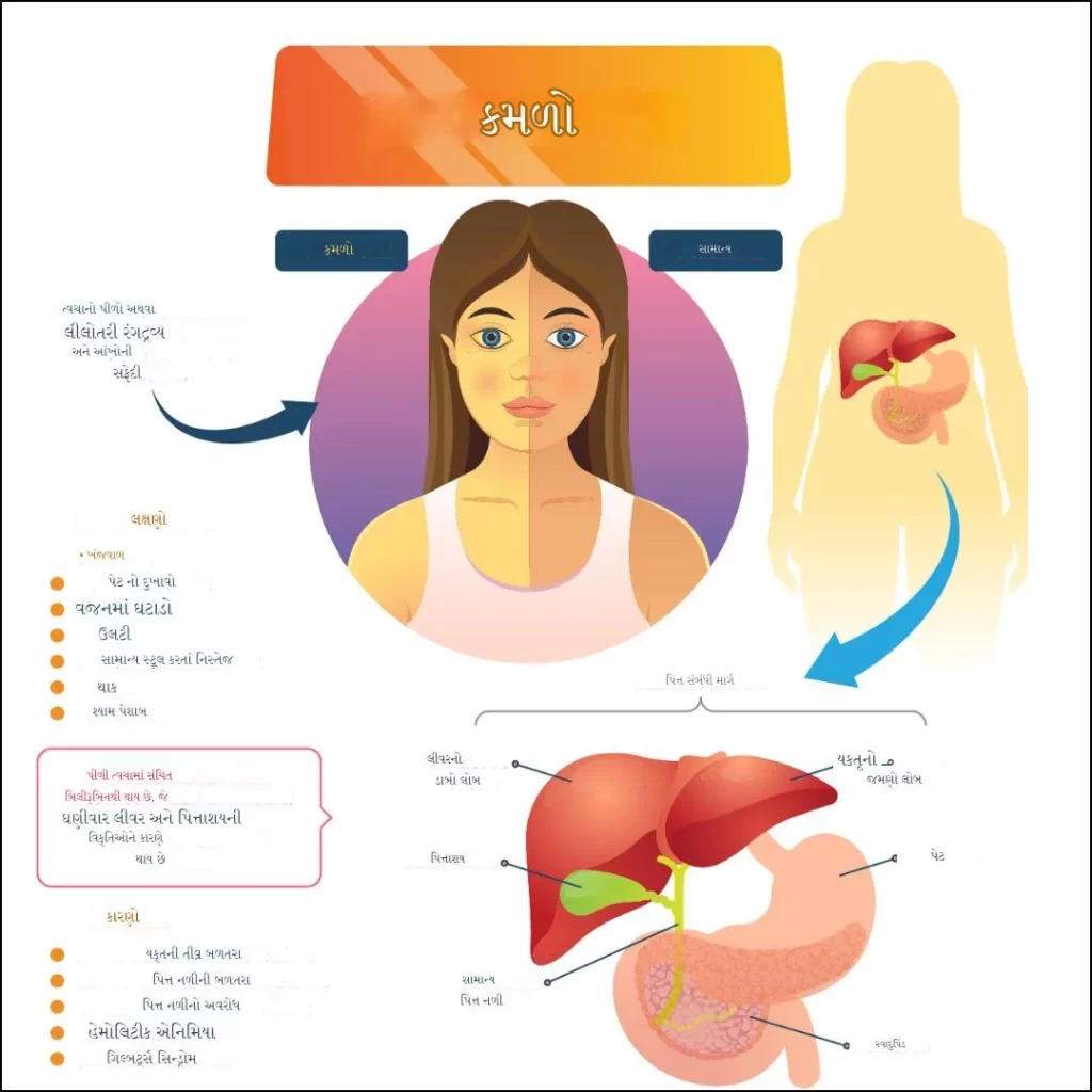 કમળોના કારણો અને લક્ષણો