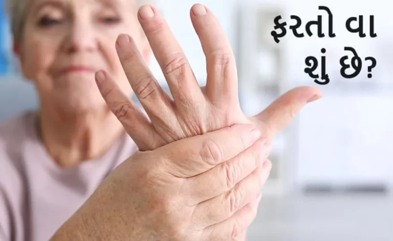 ફરતો વા- રુમેટોઇડ આર્થરાઇટિસ (Rheumatoid Arthritis)