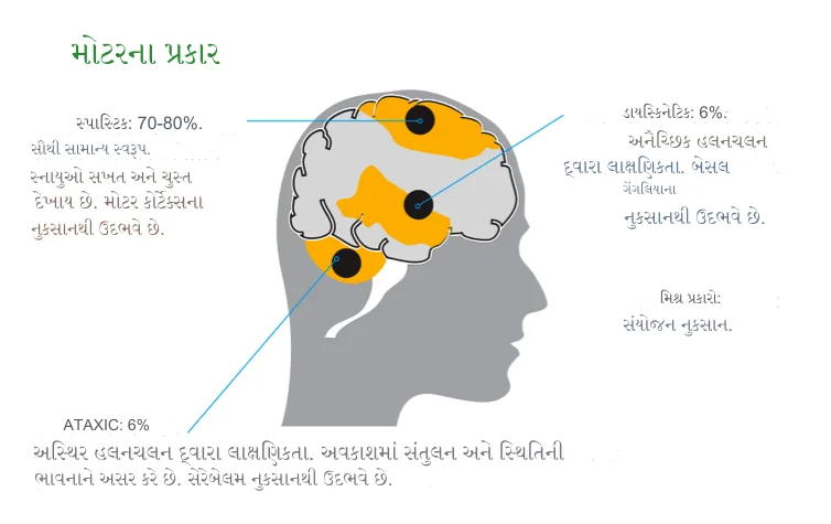 સેરેબ્રલ પોલ્સી – બાળ લકવો (Cerebral Palsy)