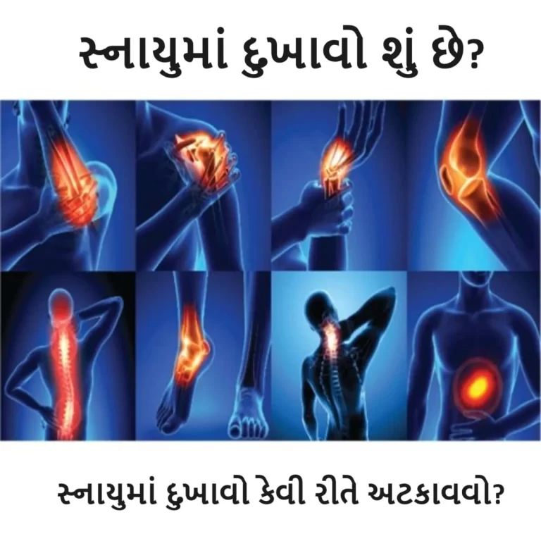 સ્નાયુમાં દુખાવો