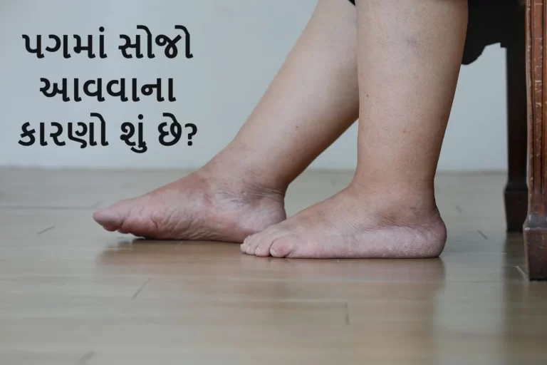 પગમાં સોજો