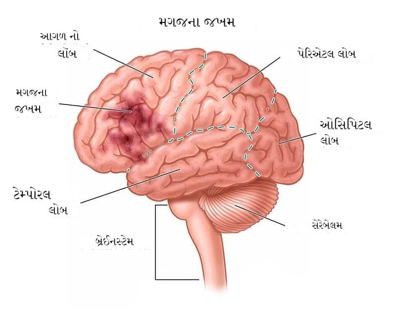 માનવ મગજ ની આકૃતિ