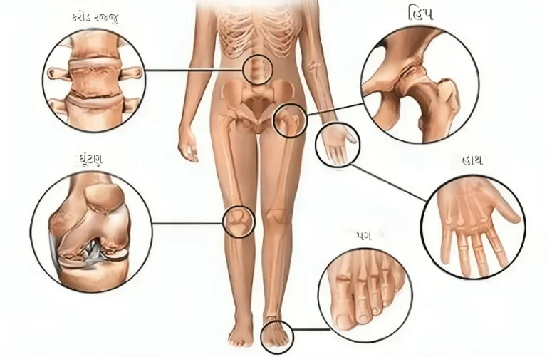 શરીરના સાંધા ના પ્રકાર