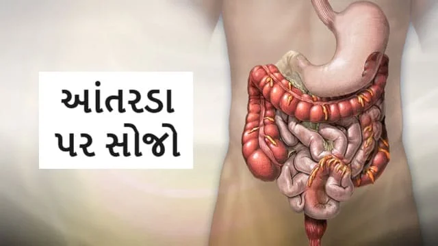 આંતરડા પર સોજો