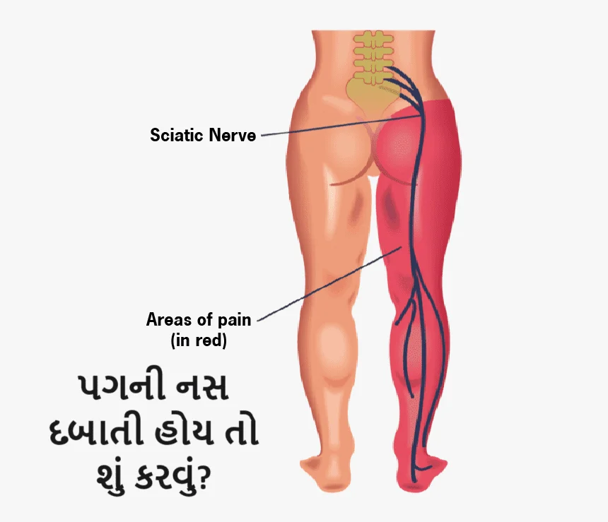 પગની નસ દબાતી હોય તો શું કરવું