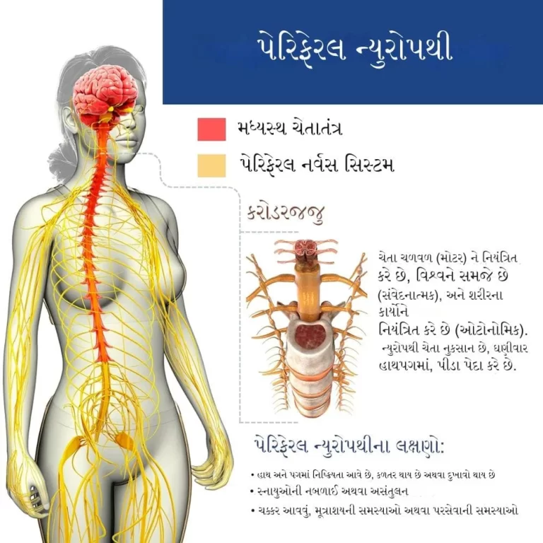 પેરીફેરલ ન્યુરોપેથી