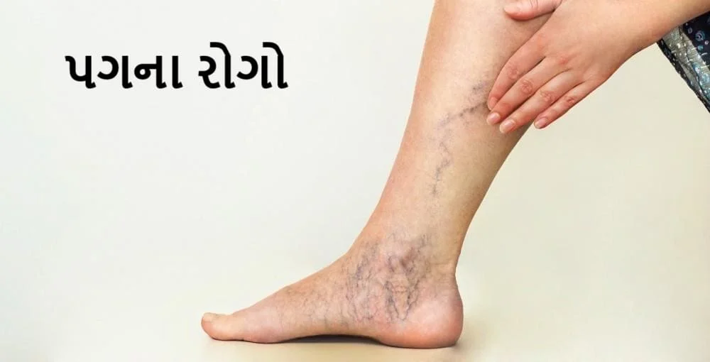 પગના રોગો