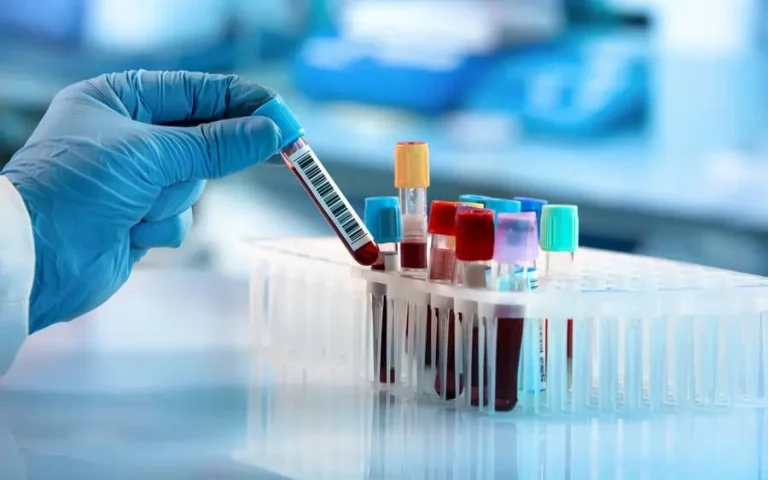 લોહીની તપાસ (Blood Test)