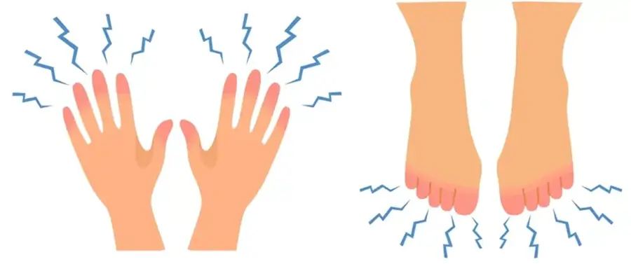 હાથ પગમાં કળતર