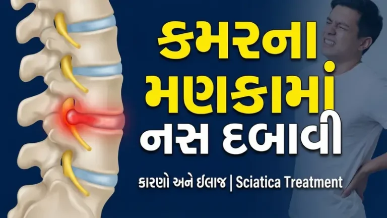 કમરના મણકામાં નસ દબાવી