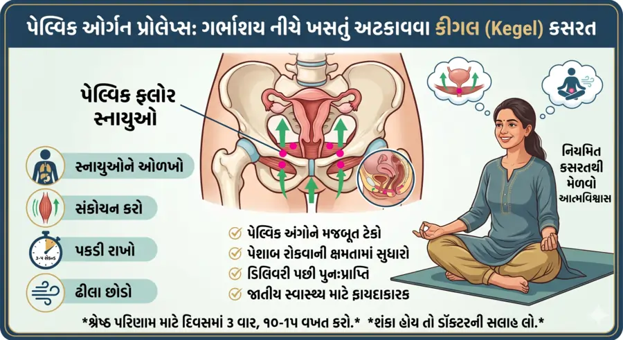 પેલ્વિક ઓર્ગન પ્રોલેપ્સ ગર્ભાશય નીચે ખસતું અટકાવવા કીગલ (Kegel) કસરત