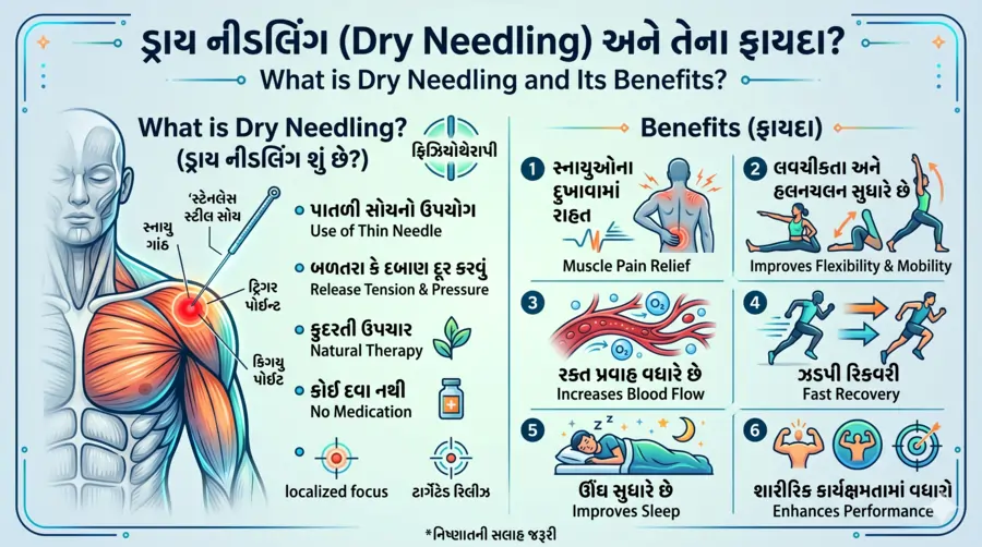 શું છે ડ્રાય નીડલિંગ (Dry Needling) અને તેના ફાયદા