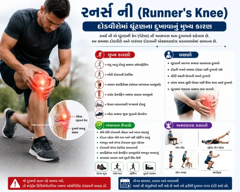 રનર્સ ની (Runner's Knee): દોડવીરોમાં ઘૂંટણના દુખાવાનું મુખ્ય કારણ