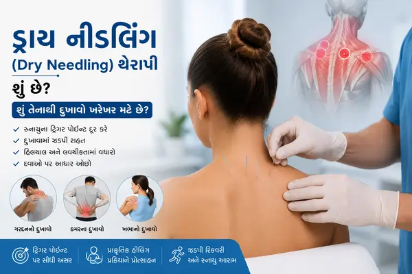 ડ્રાય નીડલિંગ (Dry Needling) થેરાપી શું છે શું તેનાથી દુખાવો ખરેખર મટે છે
