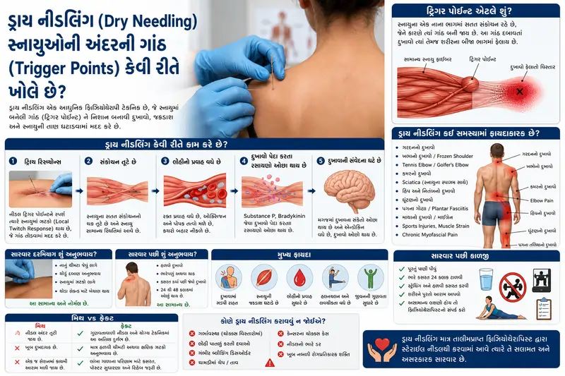 ડ્રાય નીડલિંગ (Dry Needling) સ્નાયુઓની અંદરની ગાંઠ (Trigger Points) કેવી રીતે ખોલે છે