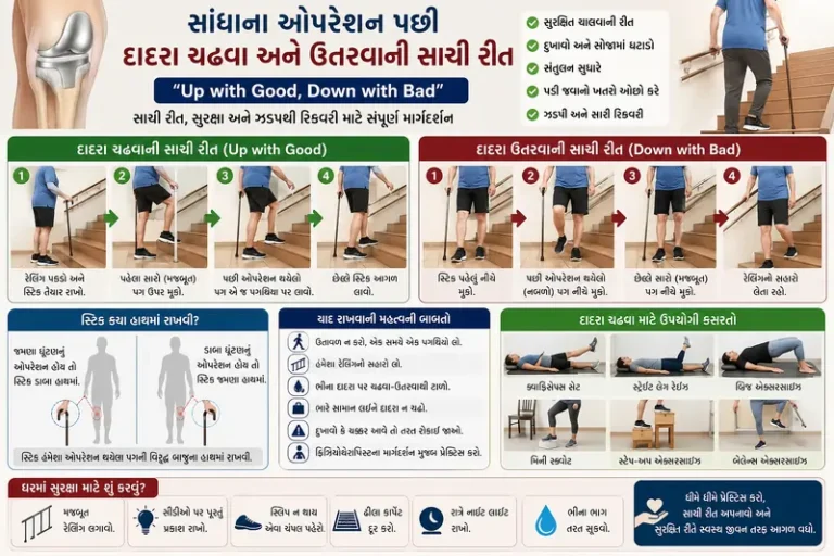 સાંધાના ઓપરેશન પછી દાદરા ચઢવા અને ઉતરવાની સાચી રીત (Up with Good, Down with Bad).