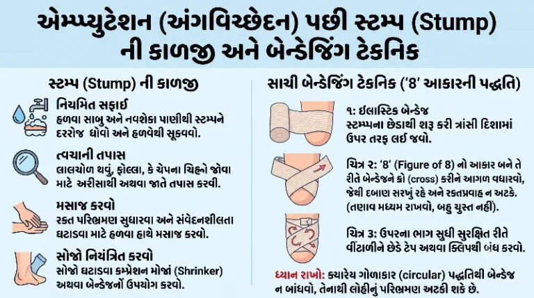 એમ્પ્પ્યુટેશન (અંગવિચ્છેદન) પછી સ્ટમ્પ (Stump) ની કાળજી અને બેન્ડેજિંગ ટેકનિક.