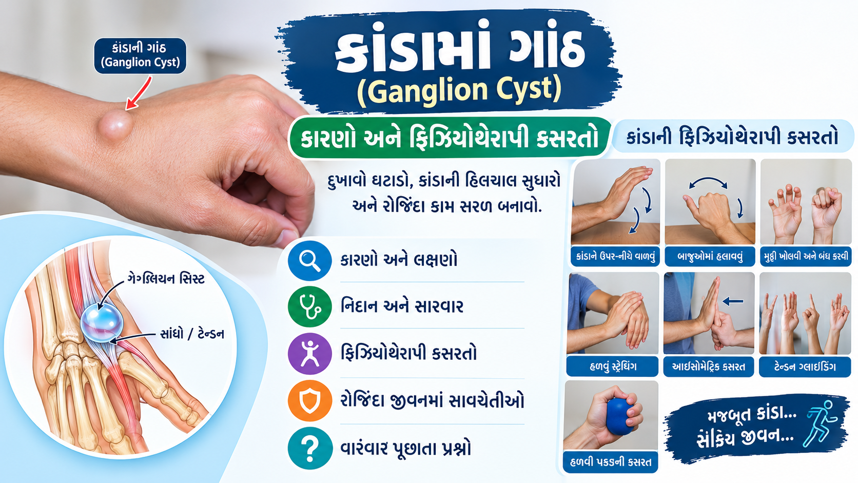 કાંડામાં ગાંઠ (Ganglion Cyst) થવી અને તેના માટે કાંડાની ફિઝિયોથેરાપી કસરતો.