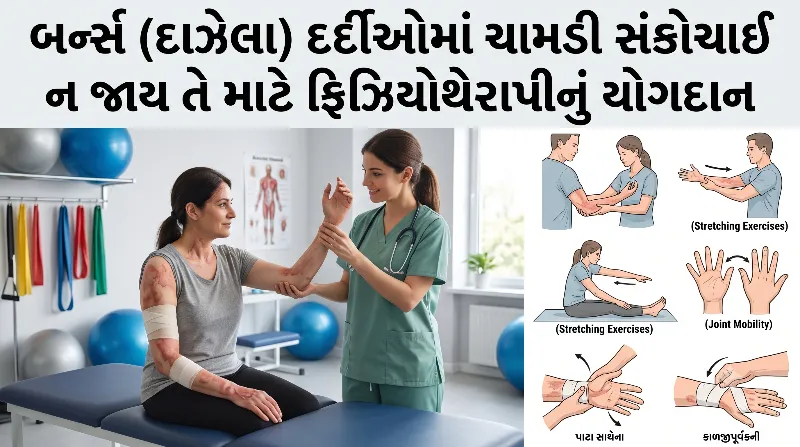 બર્ન્સ (દાઝેલા) દર્દીઓમાં ચામડી સંકોચાઈ ન જાય તે માટે ફિઝિયોથેરાપીનું યોગદાન.