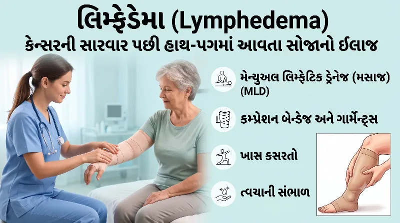 લિમ્ફેડેમા (Lymphedema) કેન્સરની સારવાર પછી હાથ-પગમાં આવતા સોજાનો ઈલાજ
